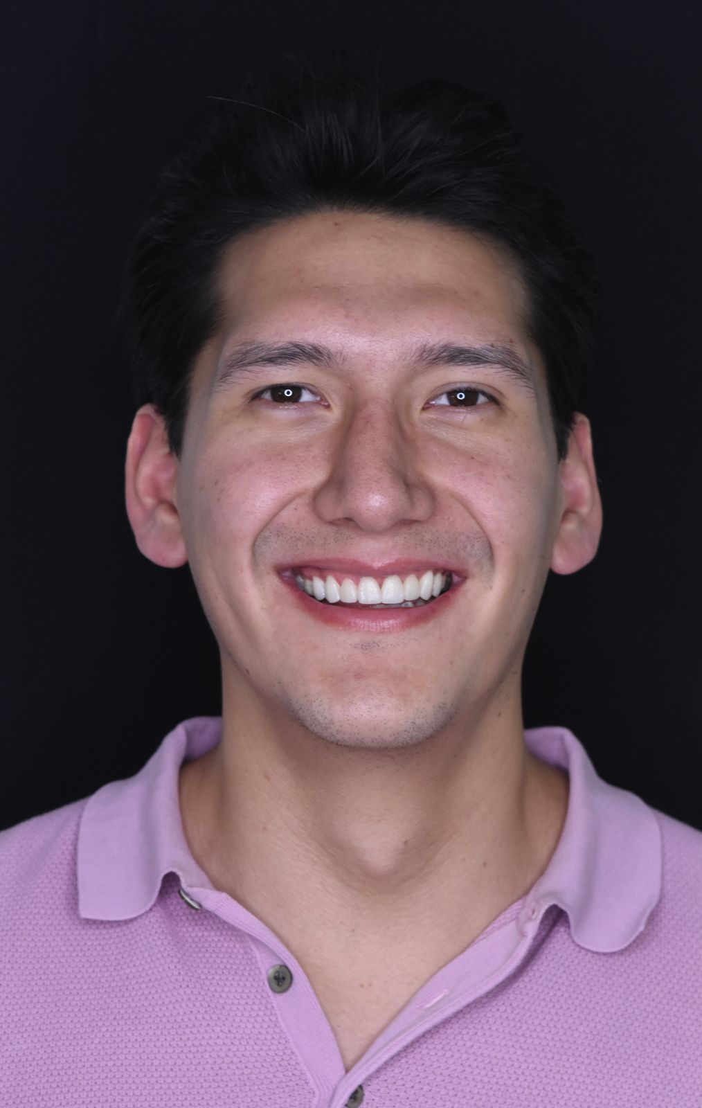Diseño de Sonrisa